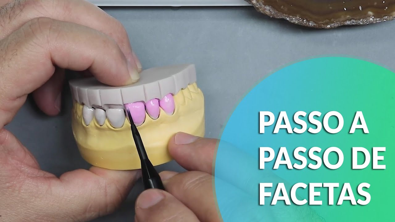 PASSO A PASSO DE FACETAS