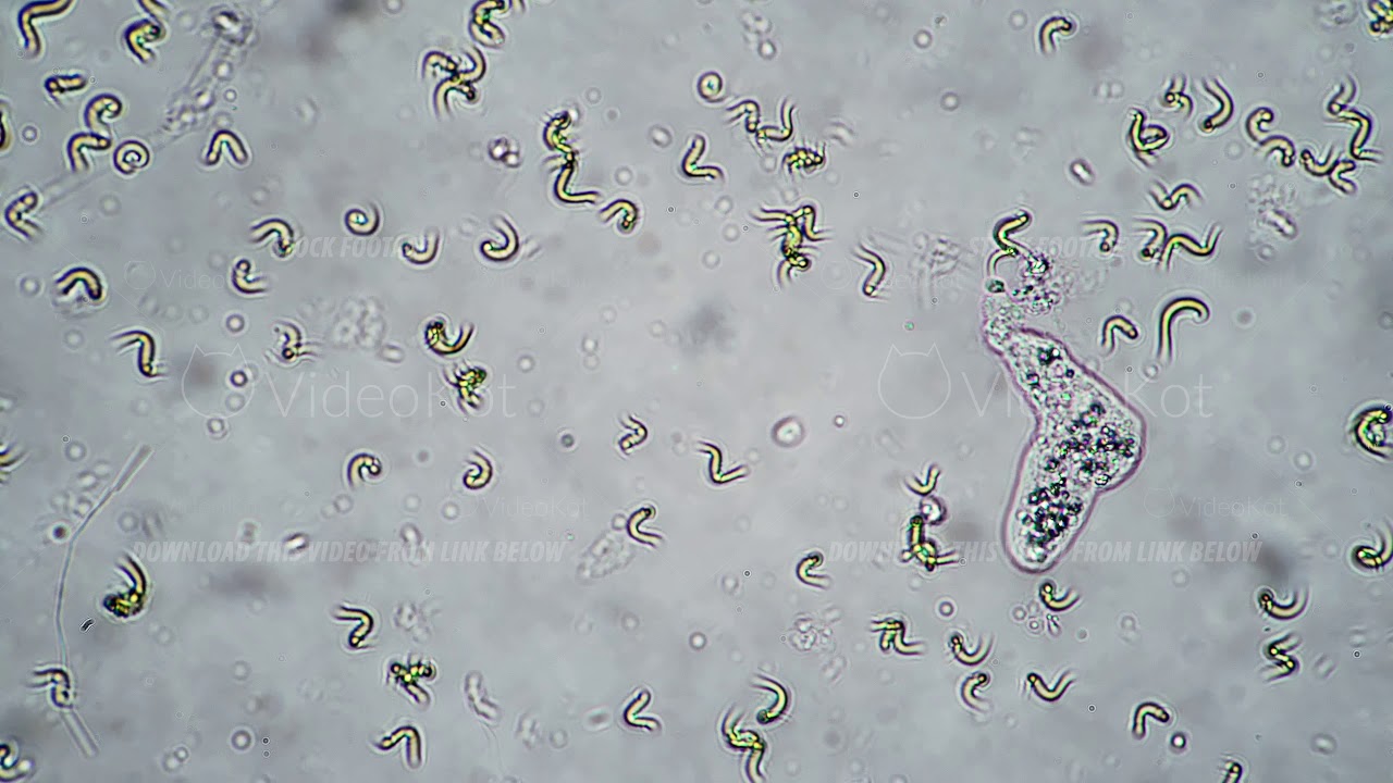 Amoeba moving in the water between the algae close-up timelapse
