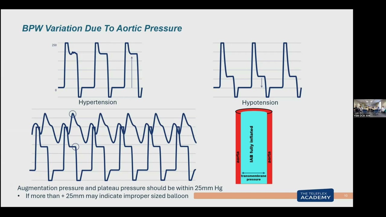 Troubleshooting the Teleflex Intra aortic Balloon Pump