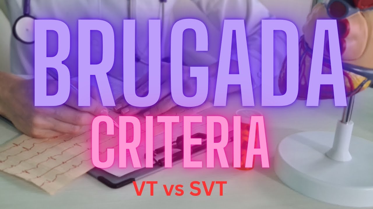 Brugada Criteria  for VT vs SVT  |  2024