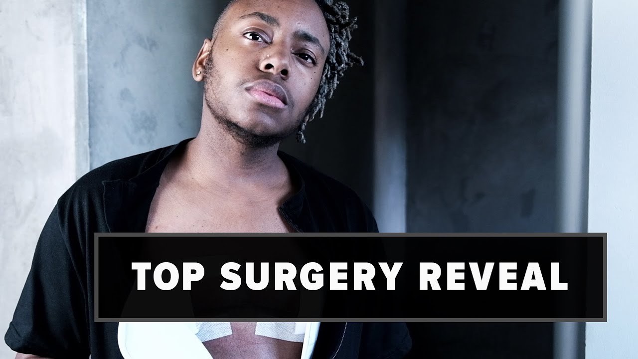 Top Surgery Reveal | Reflecting, Recovery & Reveal