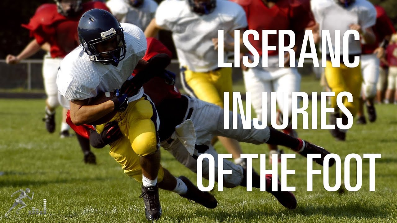 Lisfranc injury: Understanding this challenging foot injury