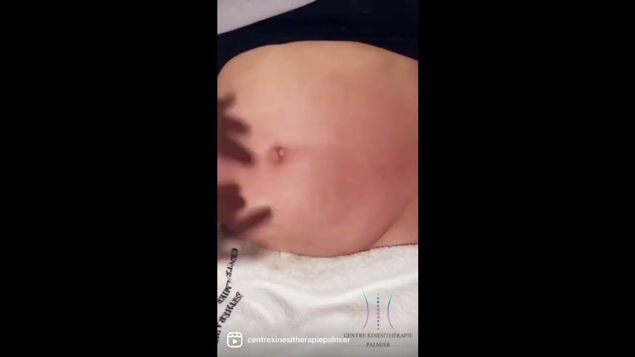 Séance de massage amincissant - Centre Kinésithérapie Palmier