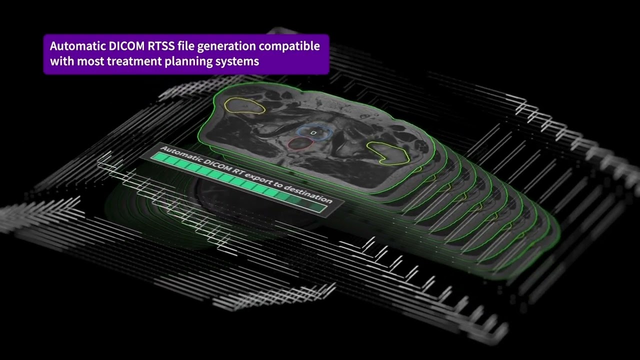 Automatically contour organs-at-risk (OAR) with MR Contour DL