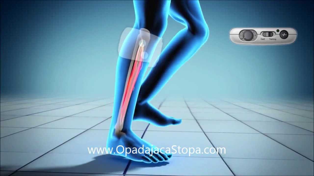Stymulator Opadającej Stopy XFT opadajacastopa.com