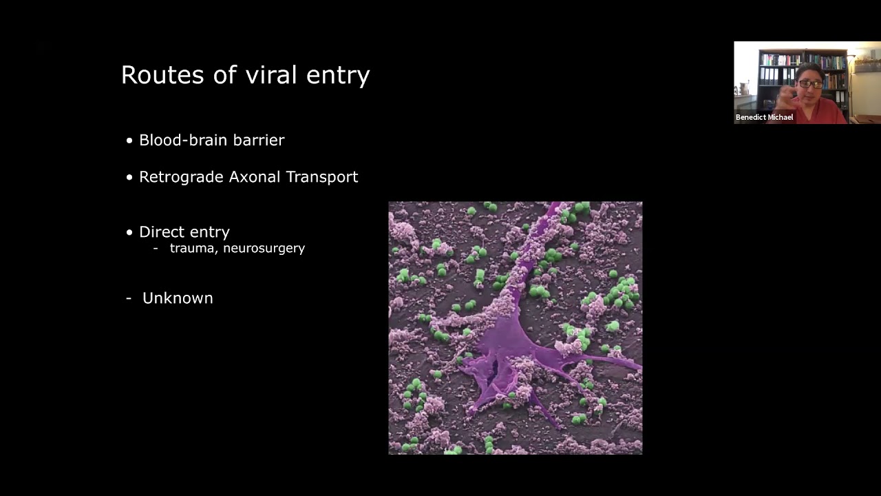 Pushing the Boundaries: Meningitis Sequelae with Dr Benedict Michael
