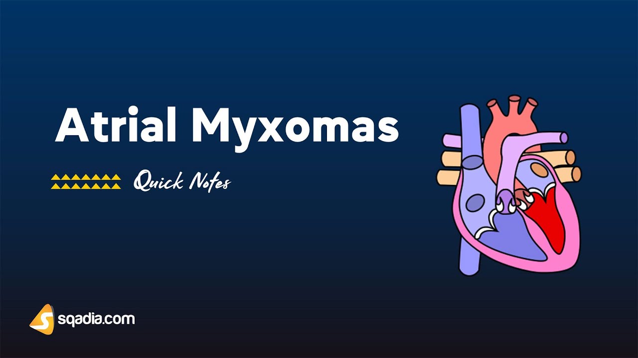 Atrial Myxomas | Introduction | Benign Tumors of the Heart | Symptoms and Diagnosis