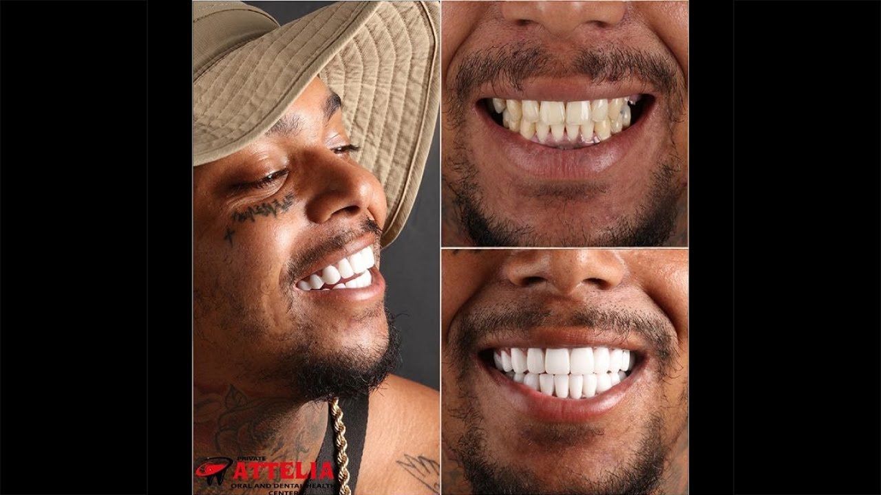Scouse Tremz (Hip-Hop/Rap) | Attelia Dental Turkey