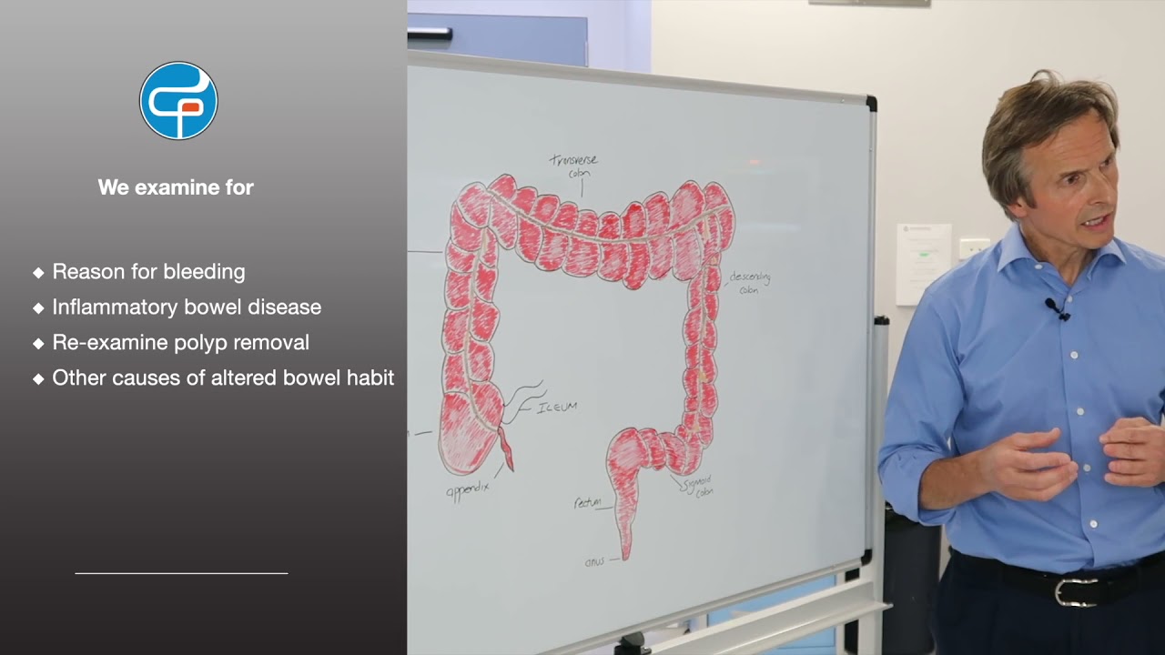 What is a Sigmoidoscopy?