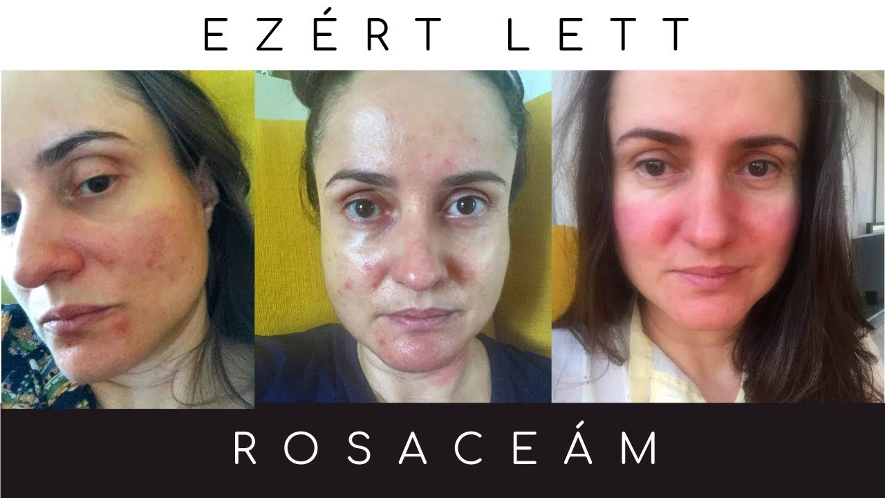 EZÉRT LETT ROSACEÁM | 🌿 Kriszta Kertesz