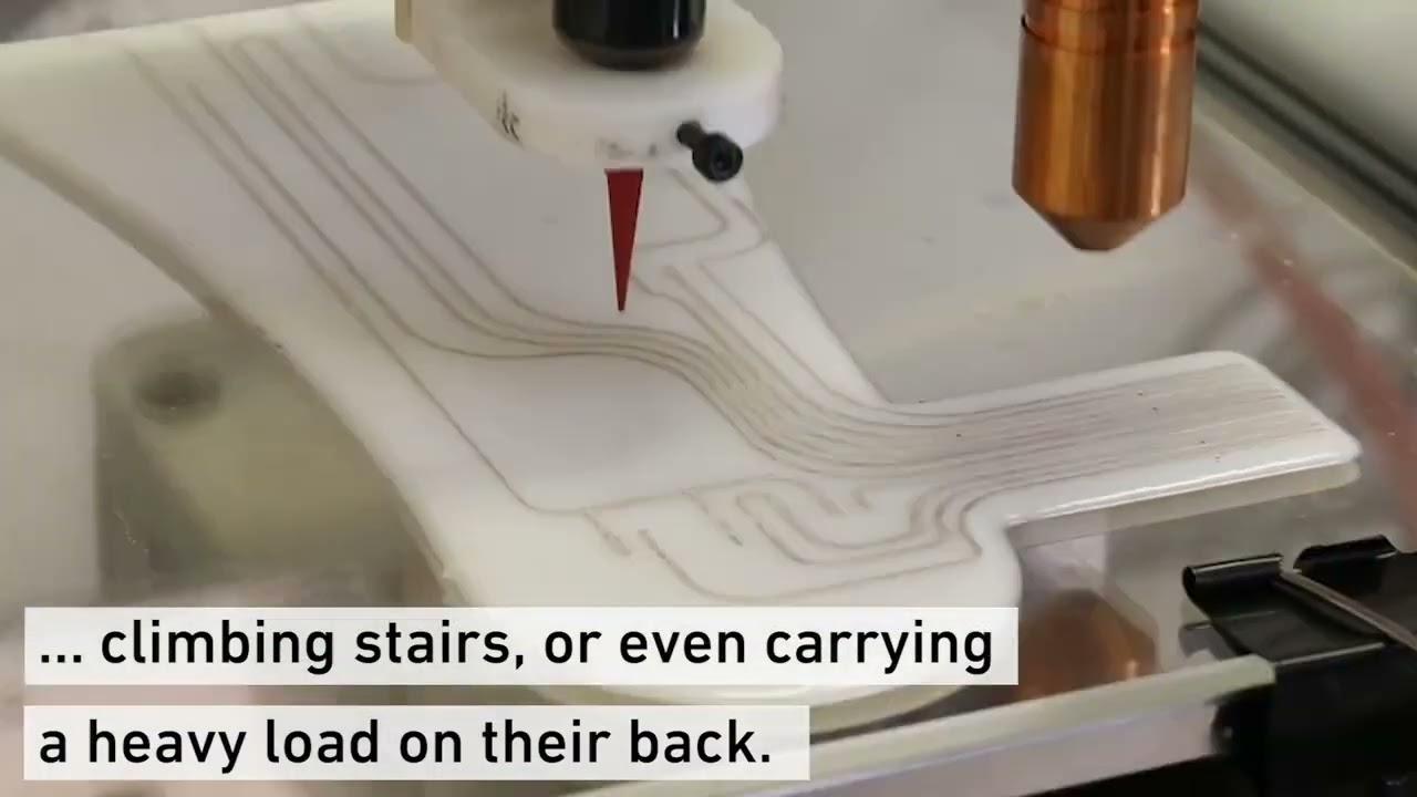 3D-printed insoles measure sole pressure directly in the shoe
