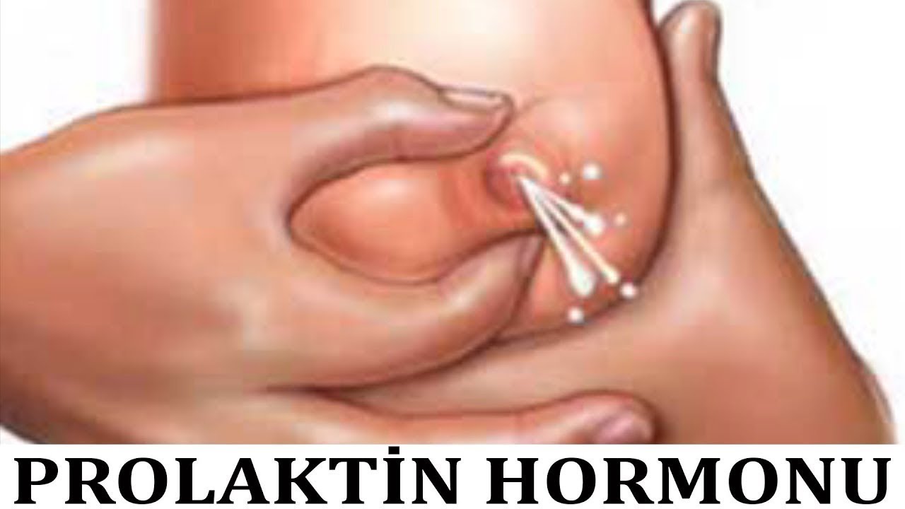 Tüklənmə, Baş Hərlənmə, Döşdən Su Gəlməsi Sizdə də Varsa Baxın