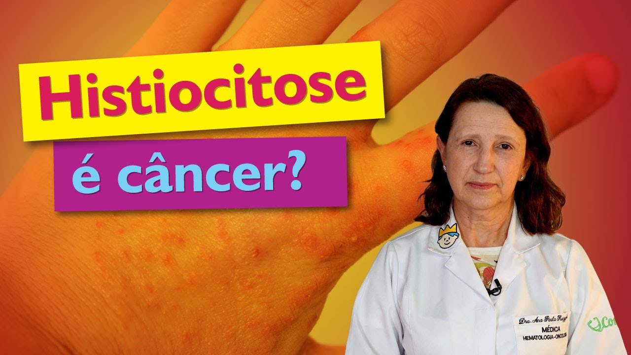 Doenças Histiocitárias: células de Langerhans, sinais e sintomas, tratamentos e mais! 🩺