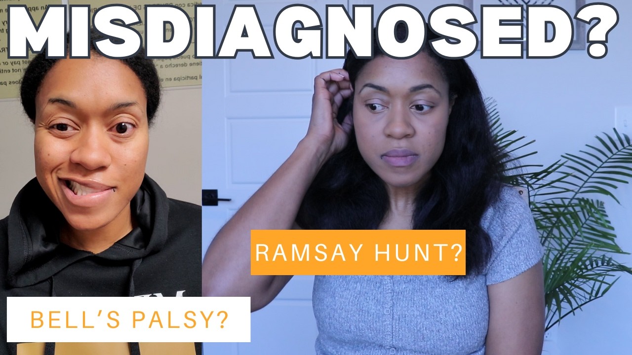Difference Between Ramsay Hunt | Misdiagnosed Bells Palsy Ramsay Hunt Syndrome