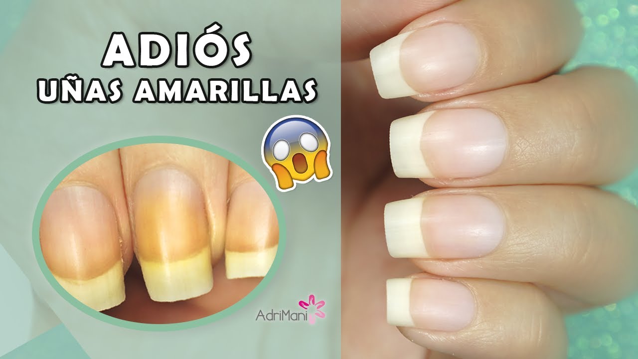 ¿Cómo blanquear uñas amarillas? Causas, Remedios Caseros y Prevención - AdriMani