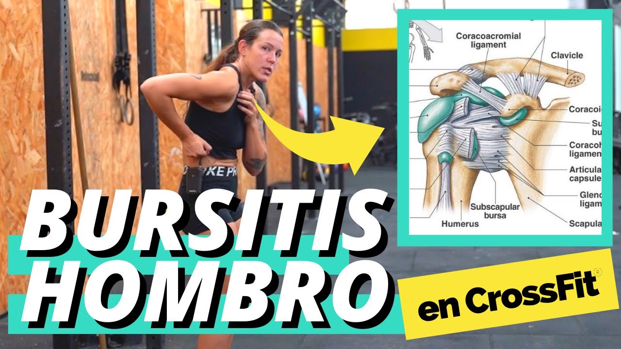 BURSITIS DE HOMBRO EN CROSSFIT + MOVILIDAD + TÉCNICA + CAUSAS Y SOLUCIONES | FISIOTERAPIA CROSSFIT