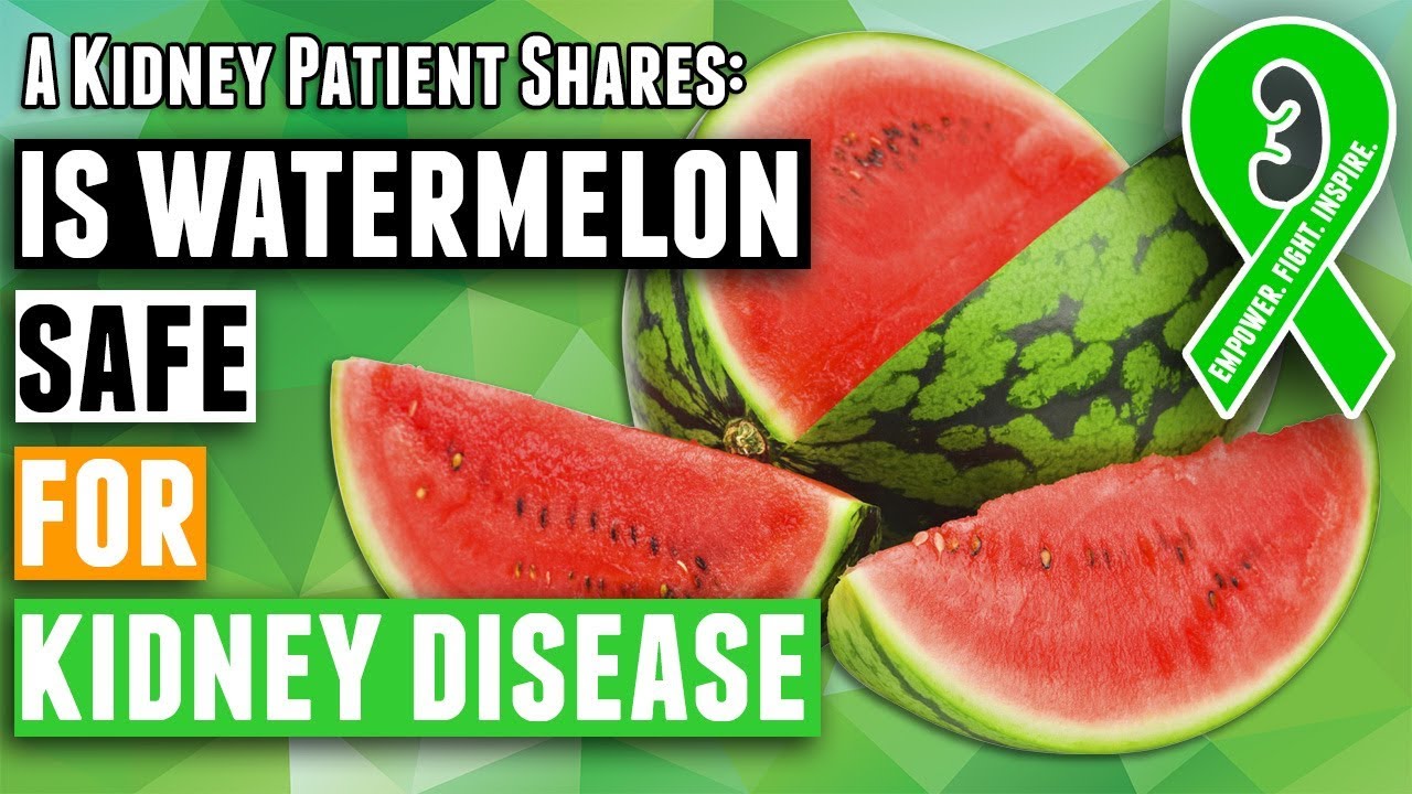 Kidney Diet Tips: Is watermelon safe for kidney disease patients on a renal diet