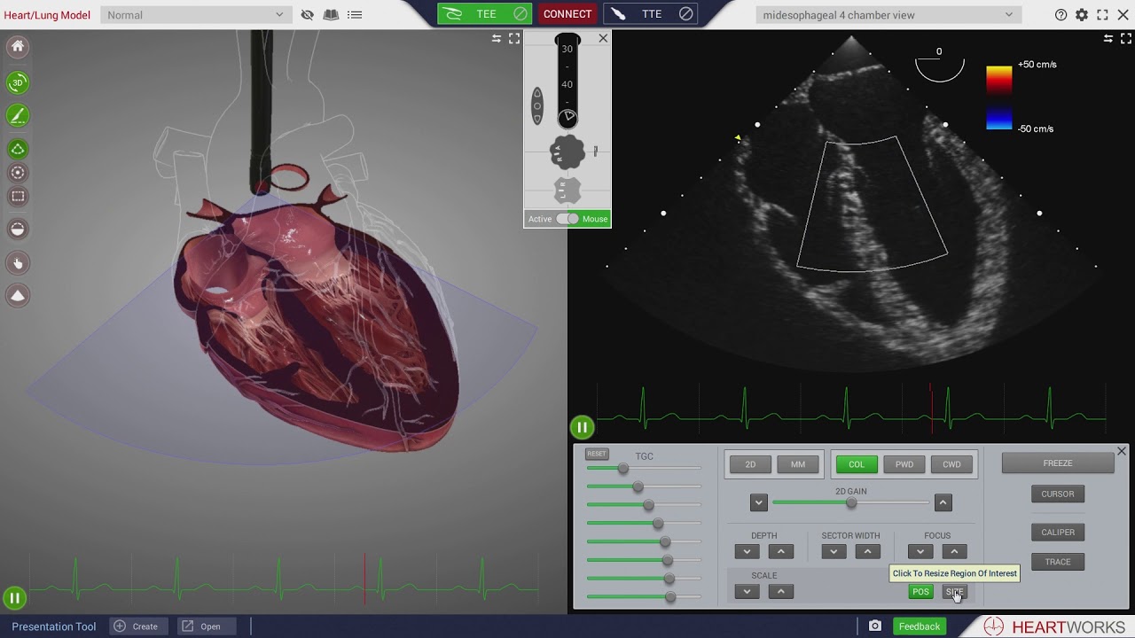 Colour Doppler Imaging - HeartWorks Issue 10