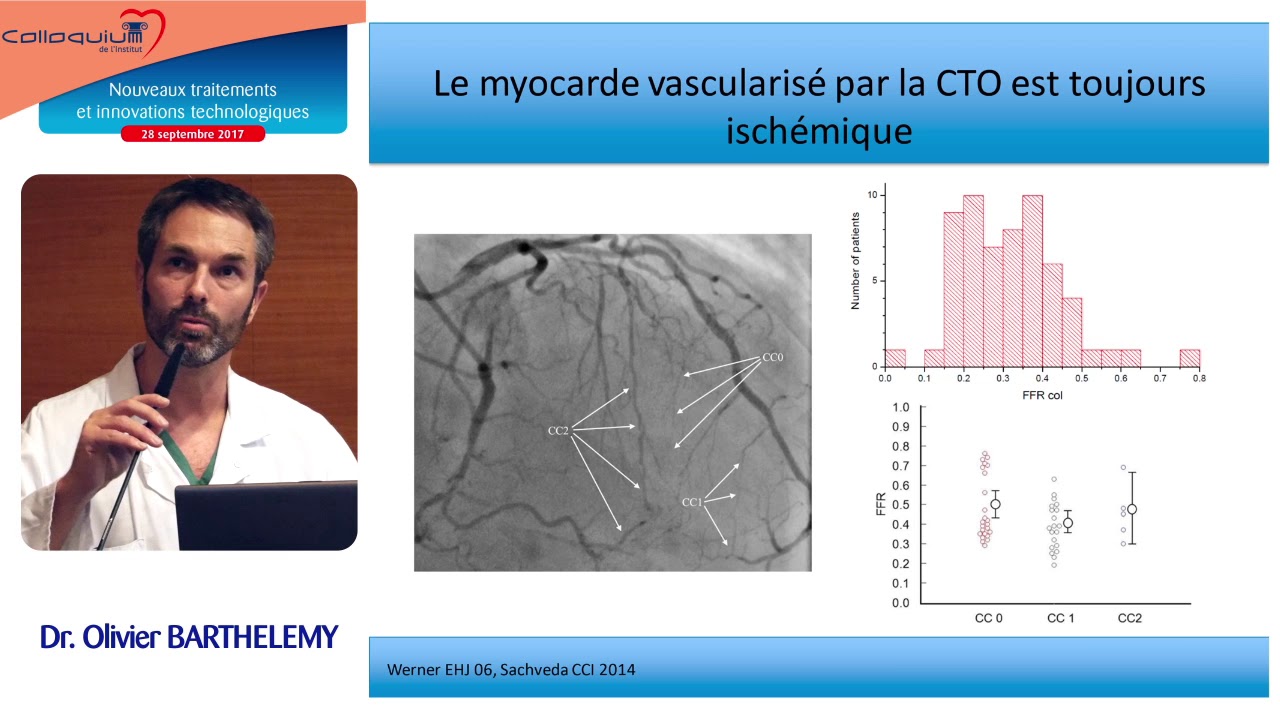 06 - Traitements des occlusions chroniques : indications