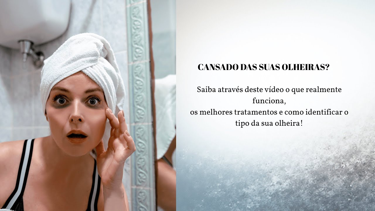 OLHEIRAS!  | Tipos de olheiras e os melhores tratamentos estéticos para cada uma 💎