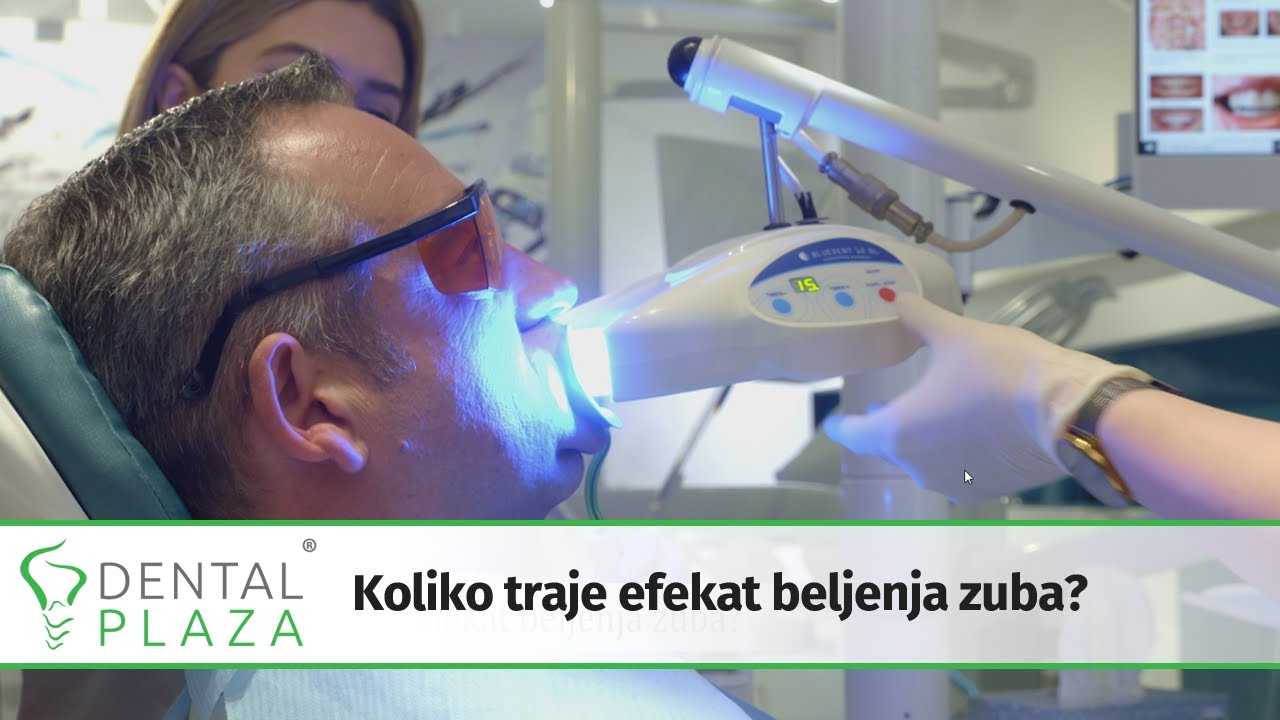 Koliko traje efekat beljenja zuba?