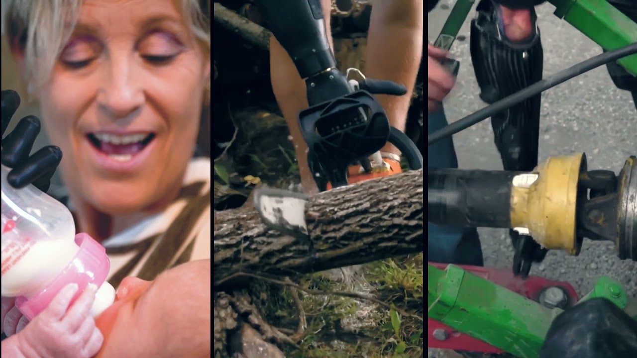 We built a bionic hand company -- PSYONIC