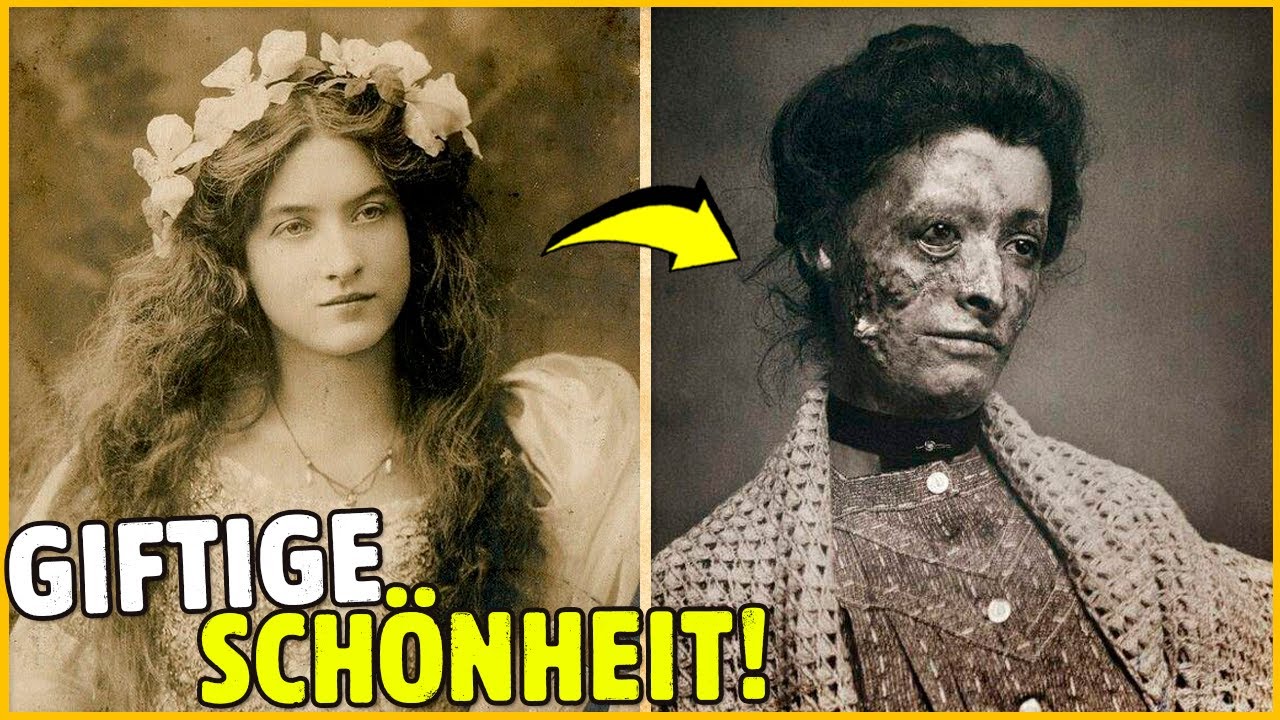 11 GIFTIGE SCH&Ouml;NHEITS-TRICKS AUS DER VIKTORIANISCHEN &Auml;RA IN ENGLAND