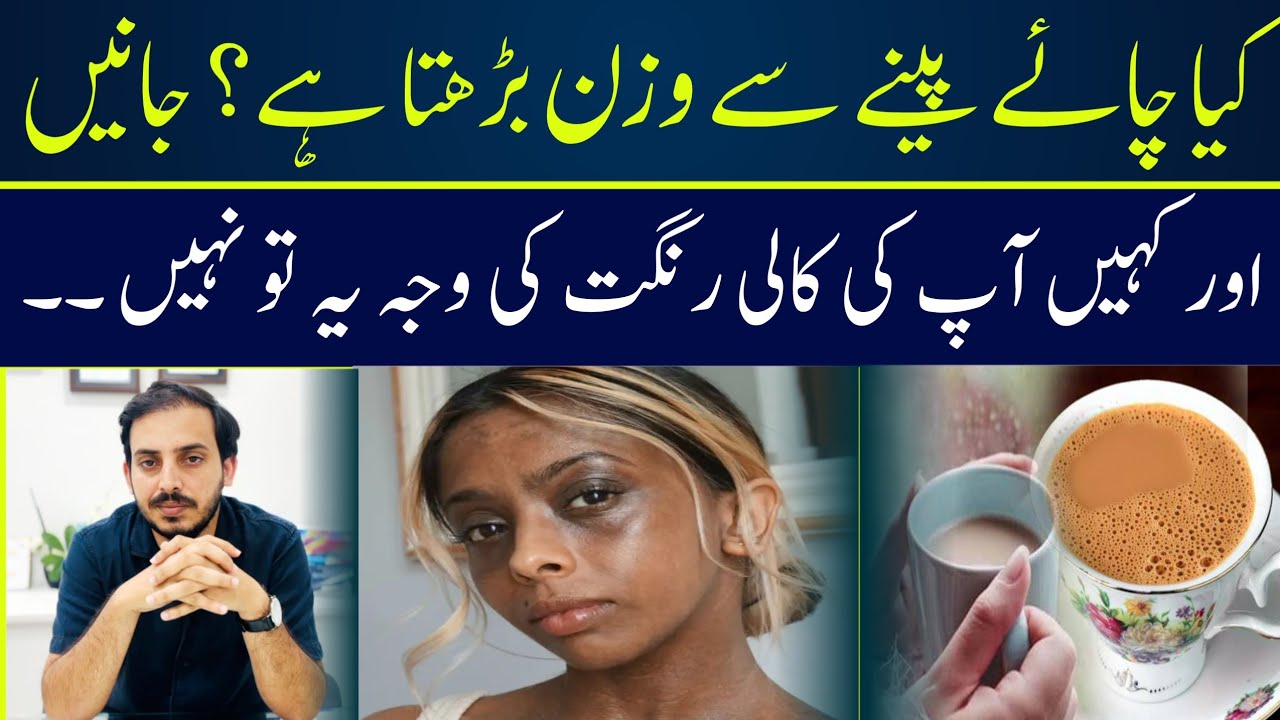 Kya Chai Peenay Sa Weight Gain Ya Rang Kala Hota Hai ? | Dr Zubair Afzal