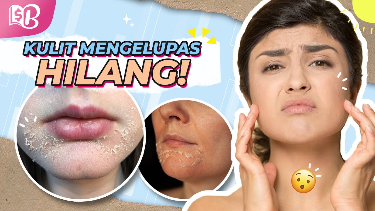 Cara Mengatasi Kulit Wajah Kering dan Kusam