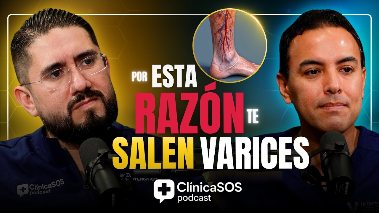 ⚠️ Las várices NO son solo ESTÉTICAS (el verdadero PELIGRO)