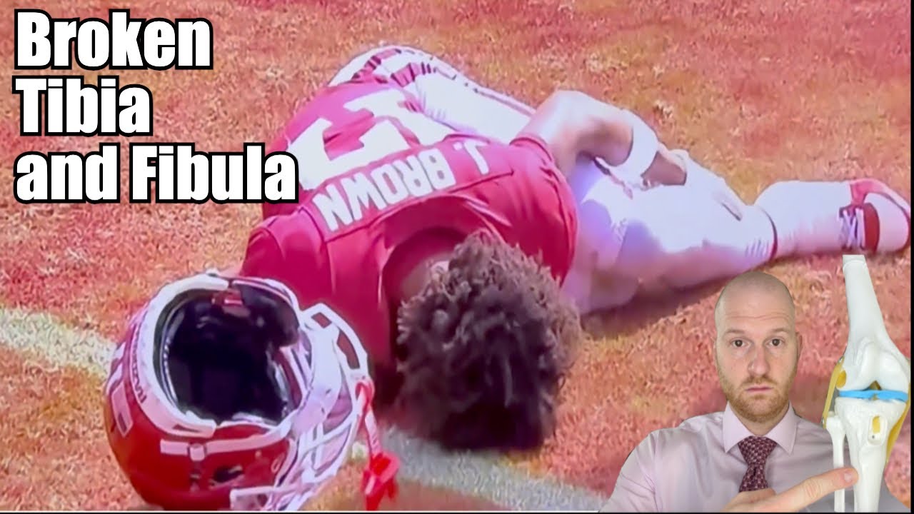 Jalen Brown Injury Update!  Jalen Brown Leg Injury
