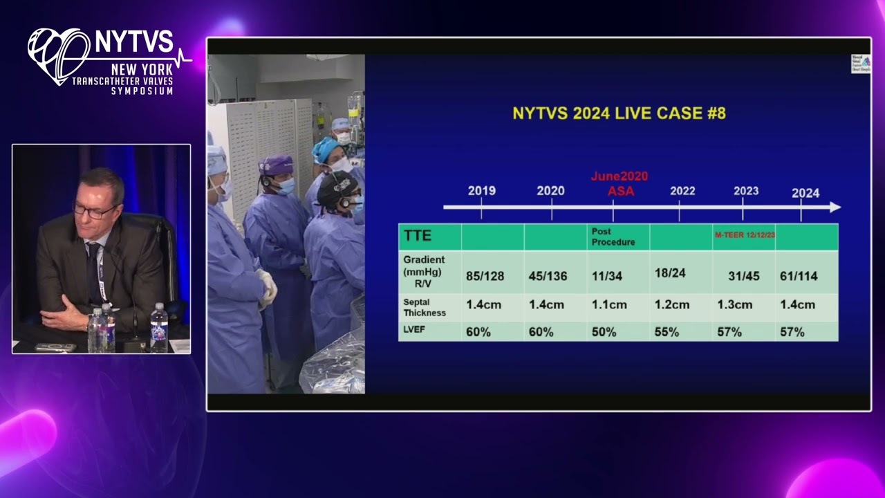 LIVE CASE 8 - ASA (Alcohol Septal Ablation)