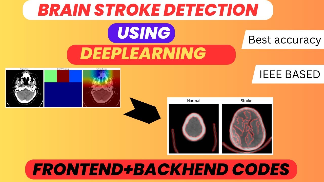 Brain Stroke Detection Using Deep Learning | Best IEEE-Based Project with Web App 2025-26