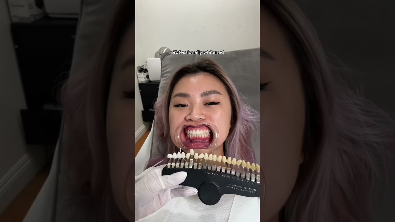 I Just Changed Teeth Whitening FOREVER