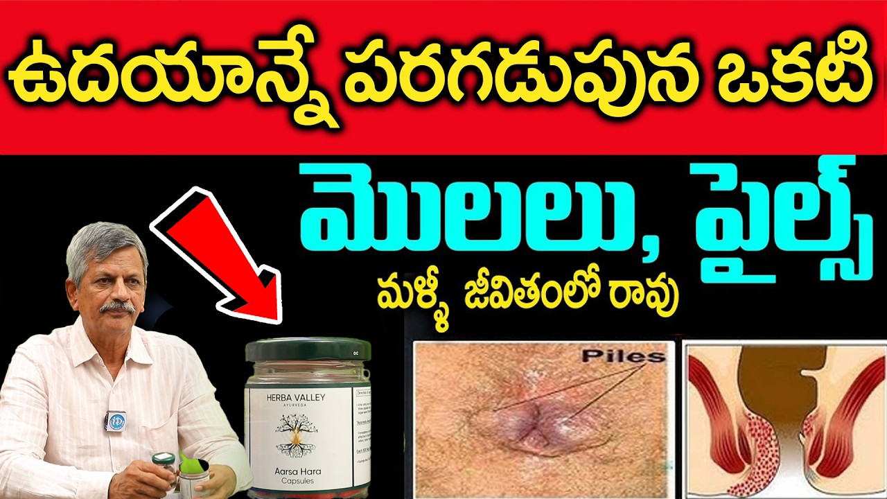 ఉదయాన్నే పరగడుపున ఒకటి చాలు మొలలు శాశ్వతంగా మాయం || eliminate the warts forever || Dr. Anjaneyaraju