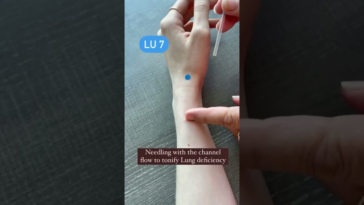 📍Needling LU 7 Acupuncture Point 