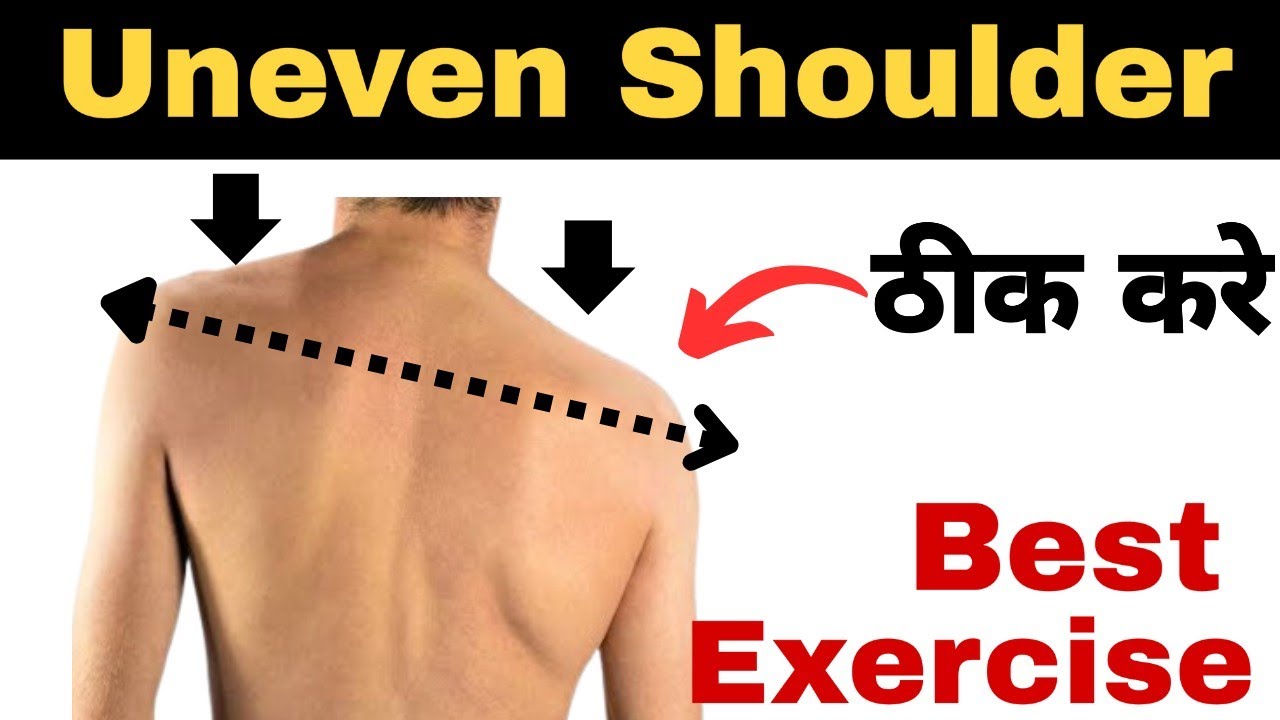 Uneven Shoulder correction Exercise in hindi.How to Correct Uneven Shoulder. 