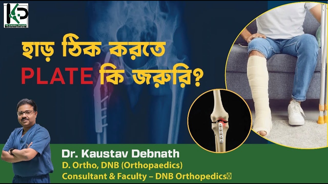 Benifits of Fracture fixation & role of Implant - Dr. Kaustav Debnath | Orthopedic