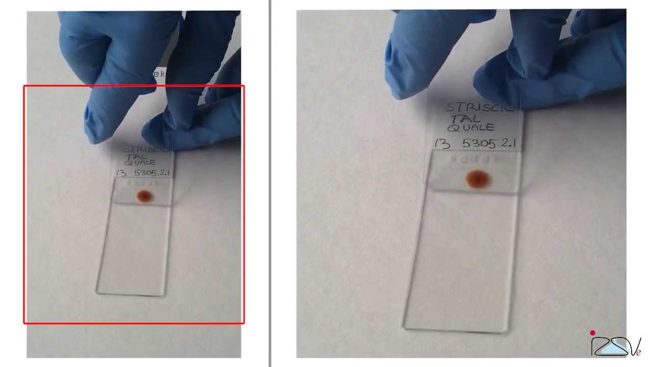 Come eseguire uno striscio [Tutorial]