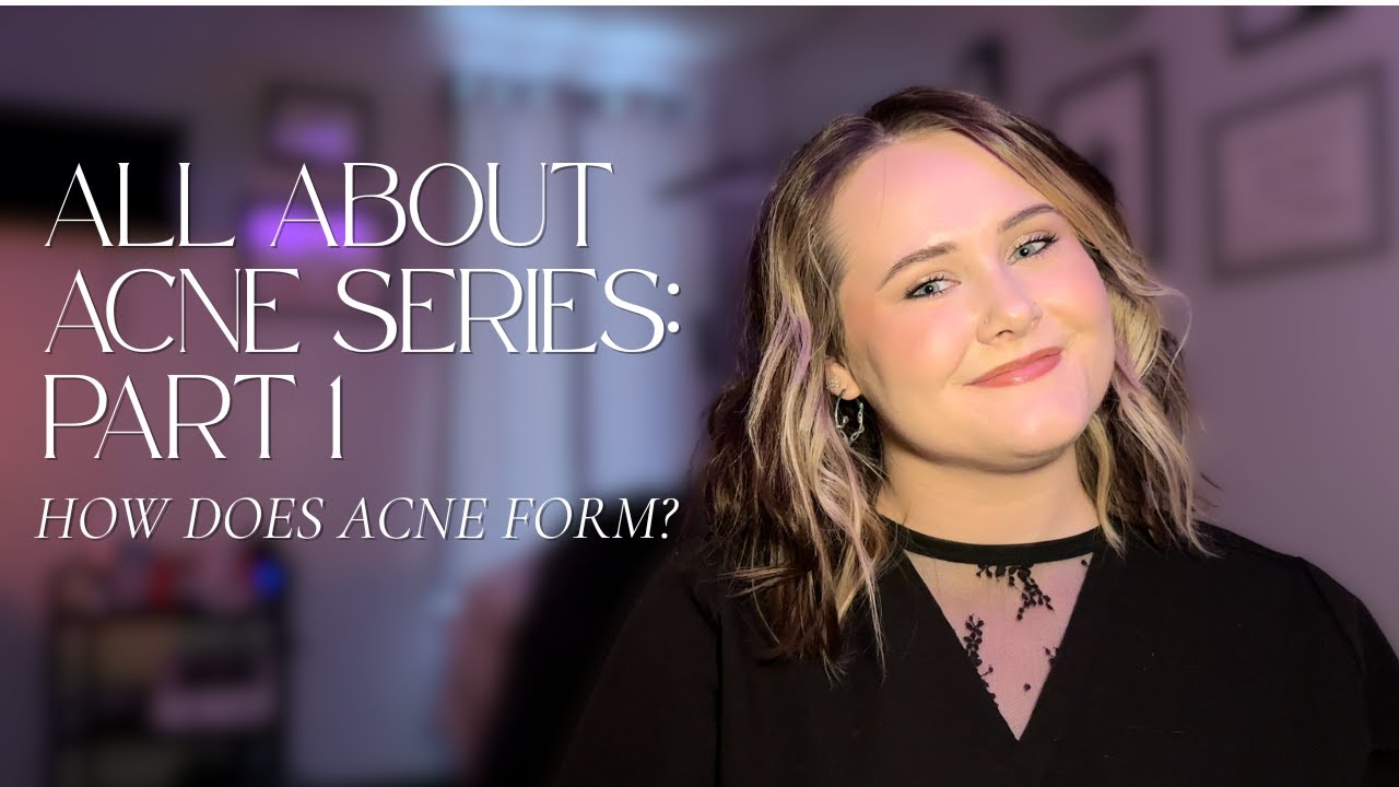 ALL ABOUT ACNE SERIES PART 1: HOW DOES ACNE FORM?