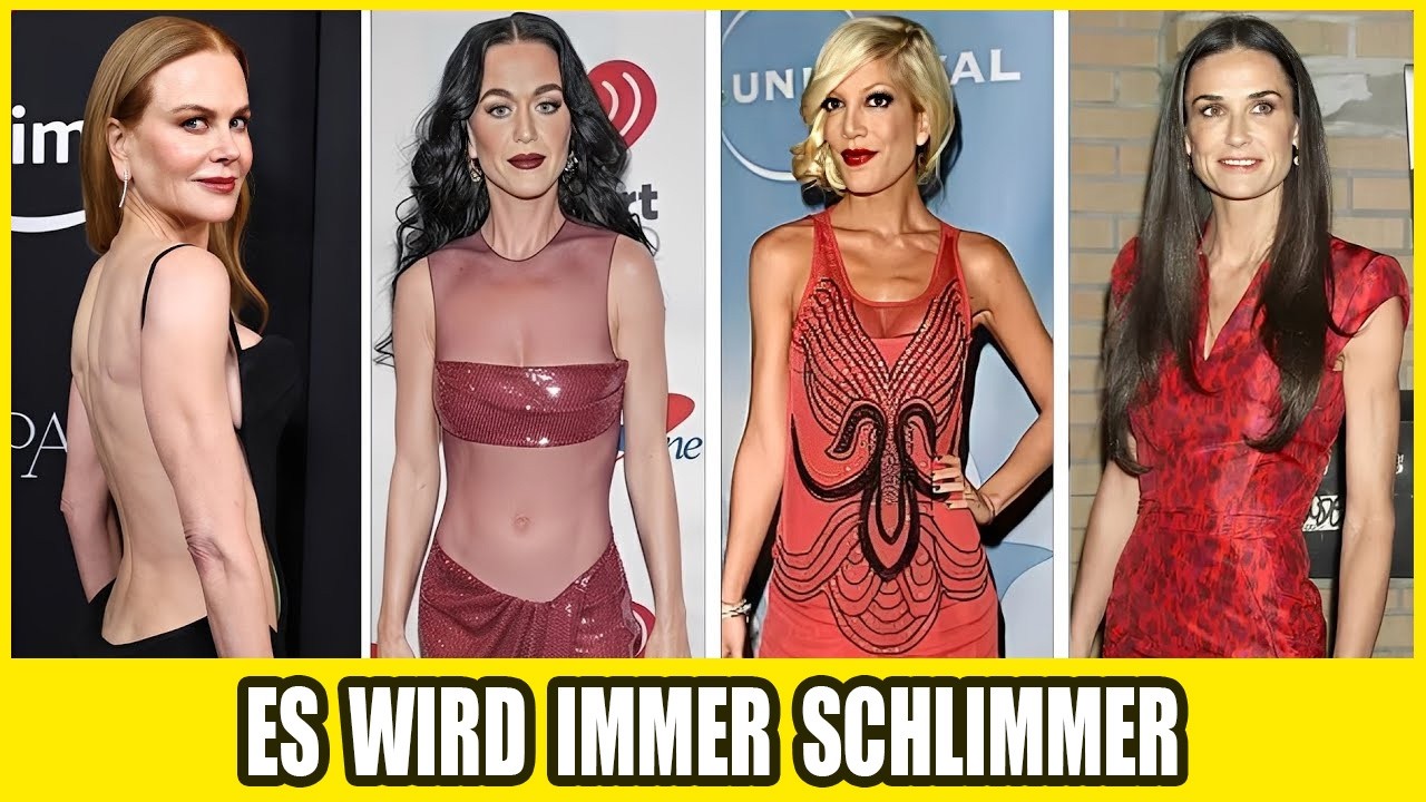 25 Prominente, Die Ozempic 2026 Komplett Und Unfassbar Verändert Hat