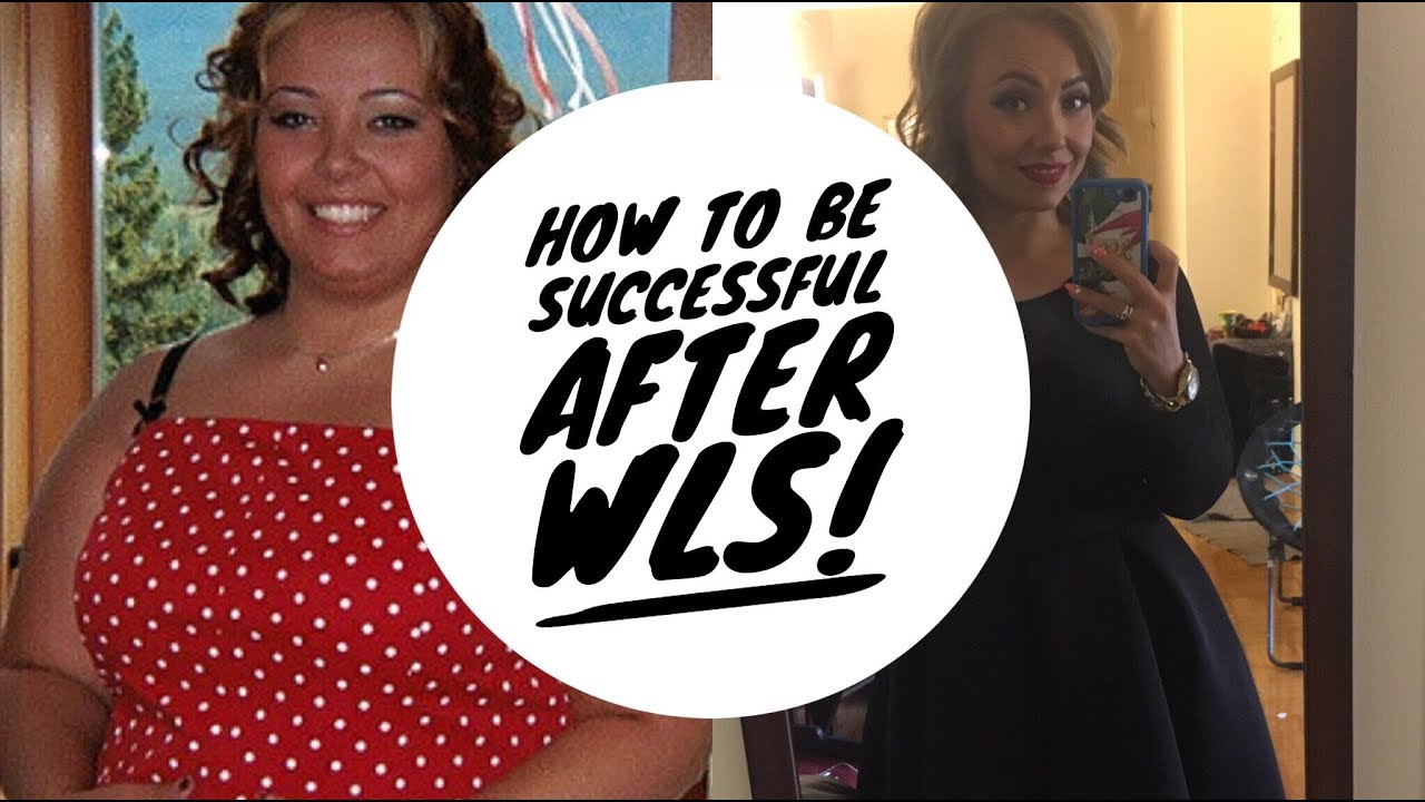 How to be SUCCESSFUL after Weight Loss Surgery!  FOREVER!