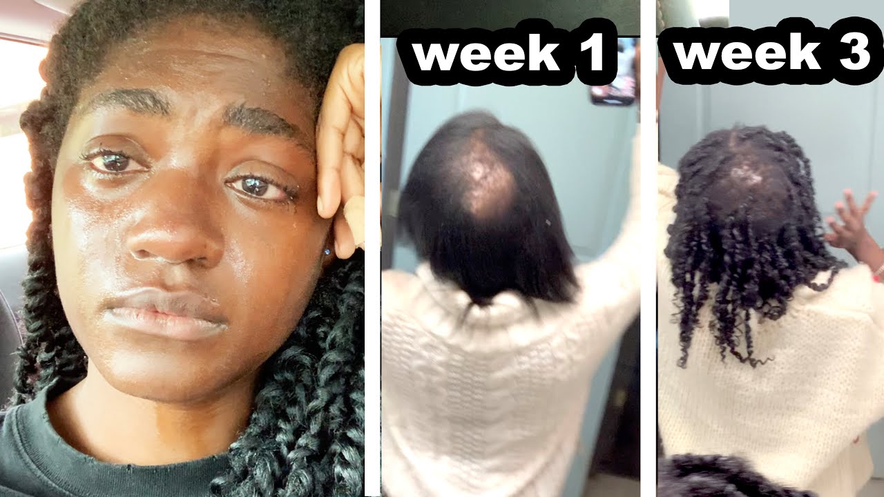 ALL My Secrets to Regrow Hair Faster | Alopecia (4C Natural Hair)