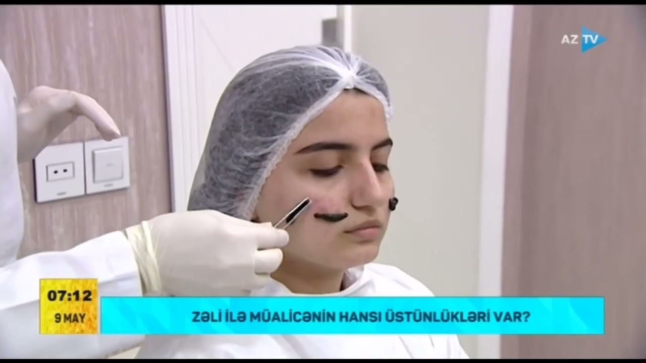 Zəli ilə müalicənin hansı üstünlükləri var?