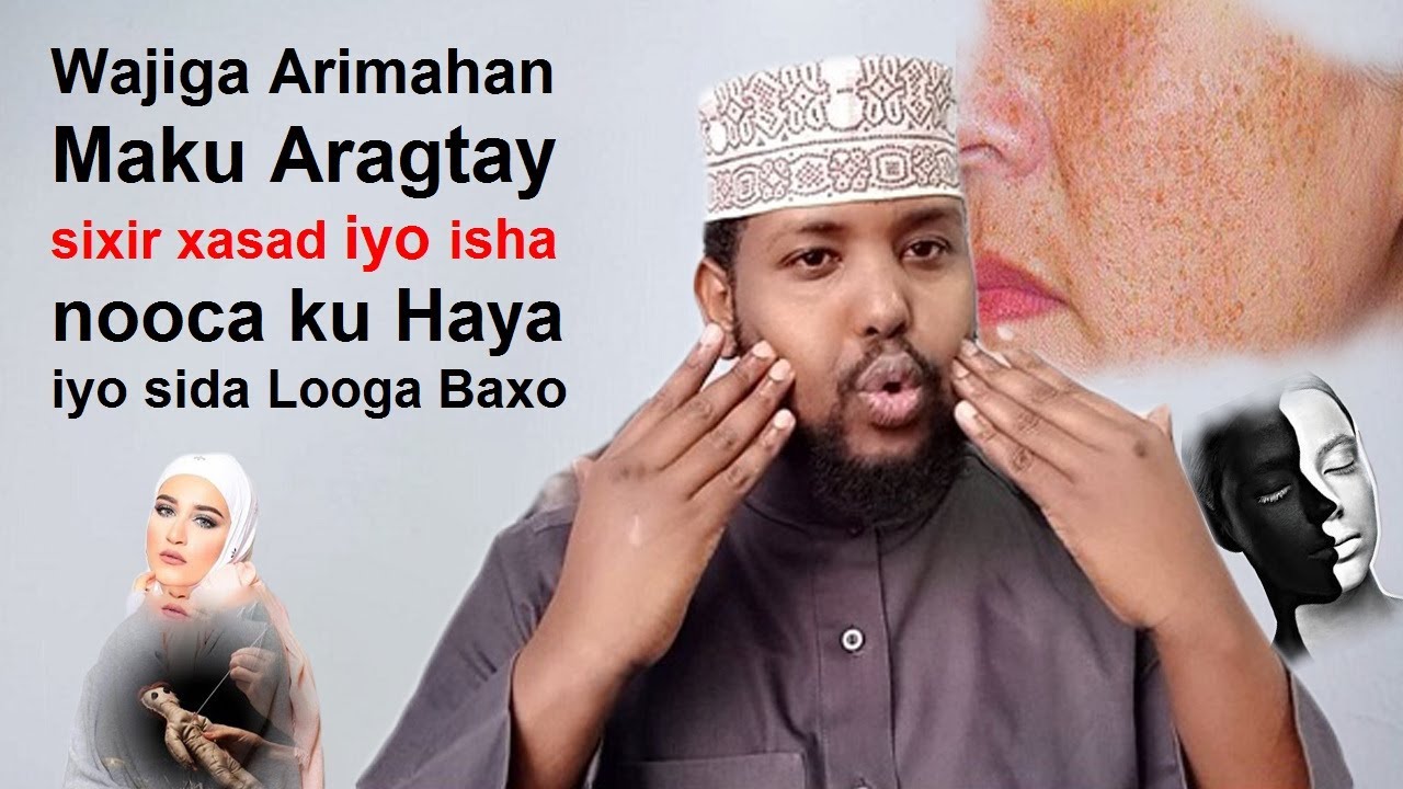 Calaamado wajiga Hadad ku aragto Garo xasadka & isha jirkaada ku jira Digniin Dadka La sixray