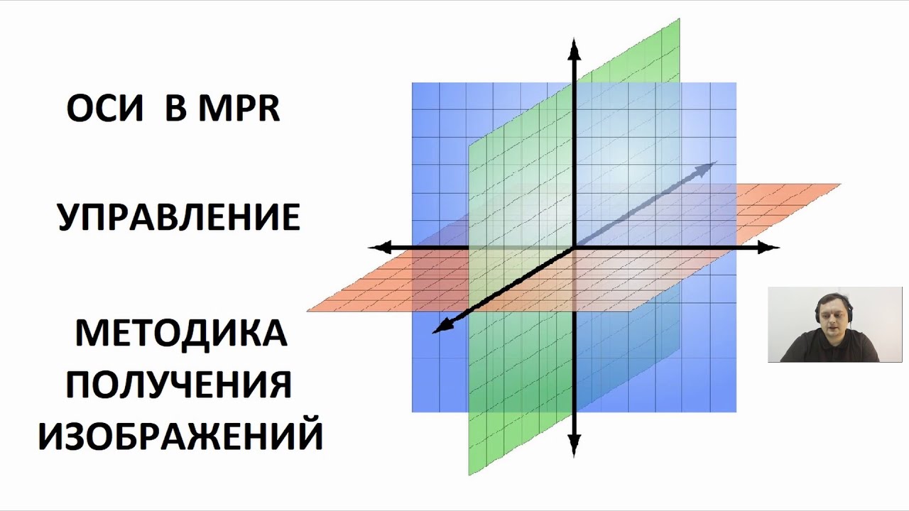 Работа с осями. Основы в MPR