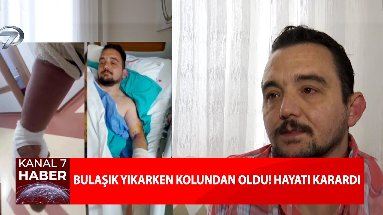 Bulaşık Yıkarken Kolundan Oldu!