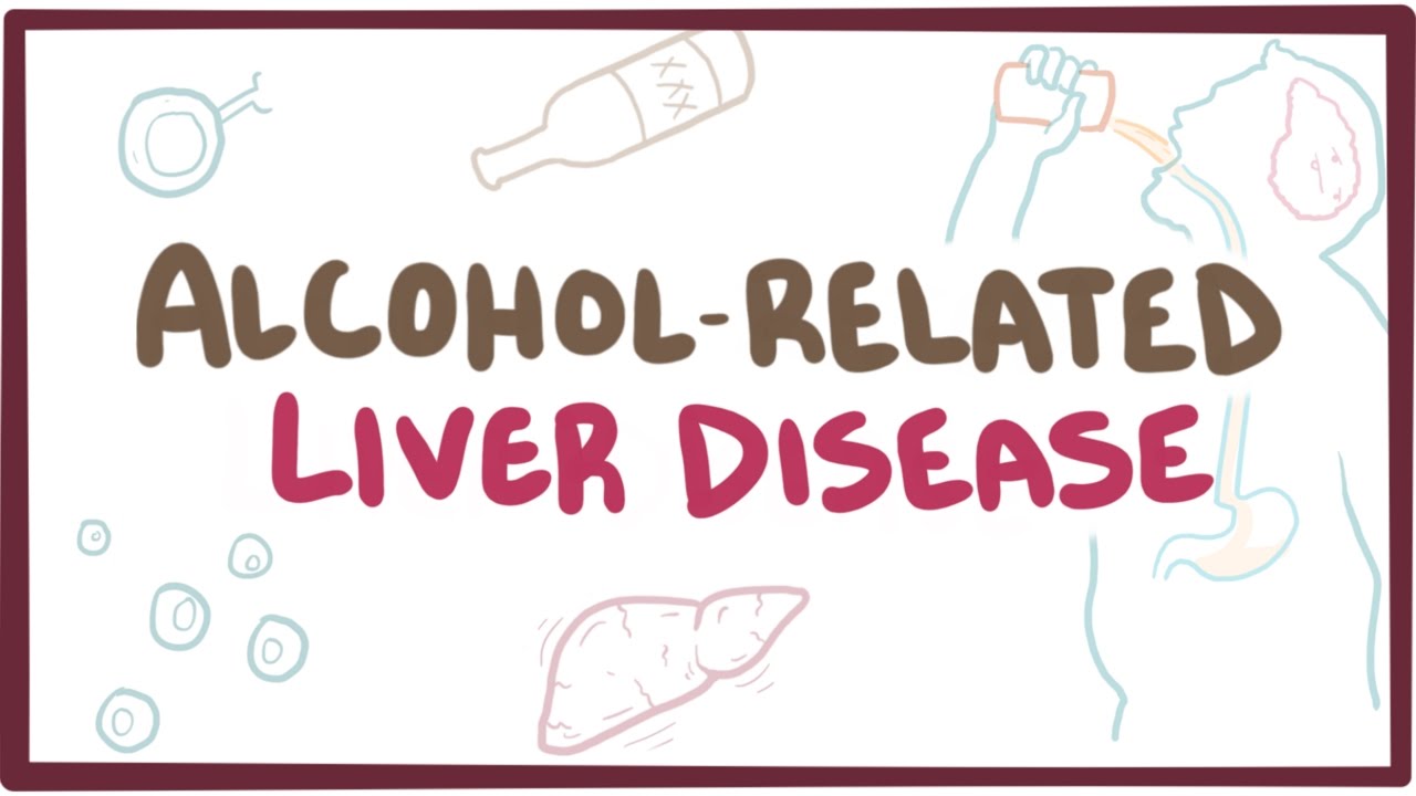 Alcohol-related liver disease - causes, symptoms & pathology