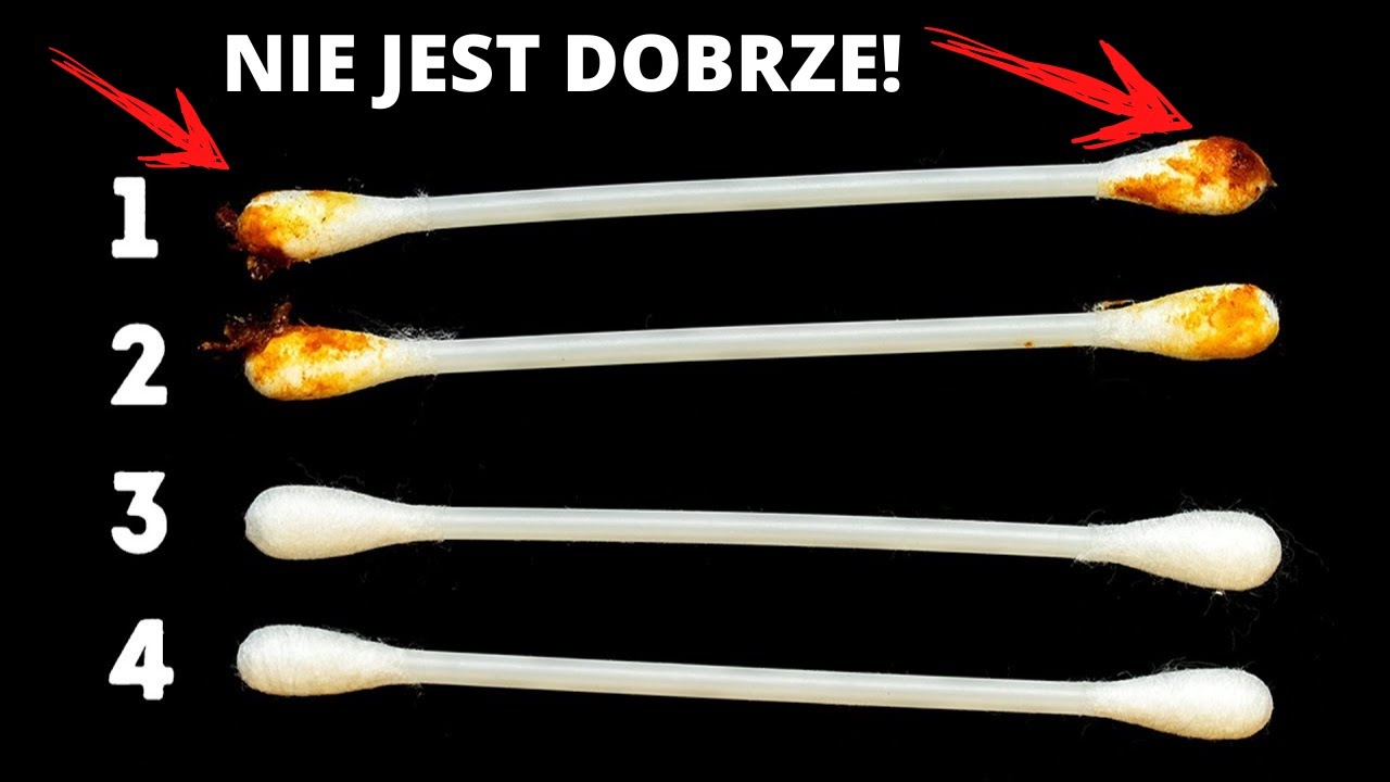 Co kolor woskowiny może mówić o Twoim zdrowiu? Przekonaj się!