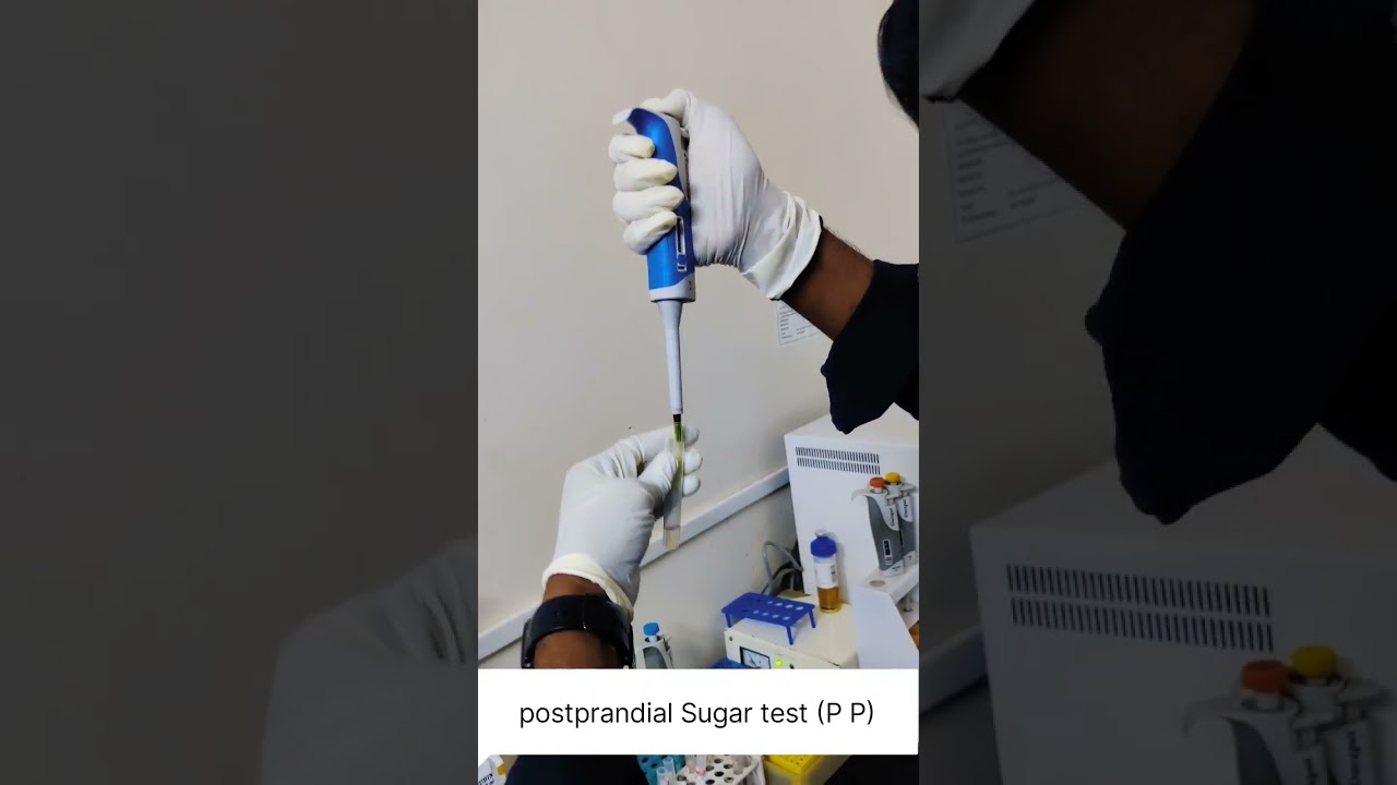 postprandial Sugar test (P P)